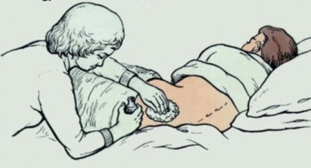 34
