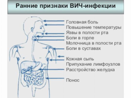 ВИЧ – инфекция