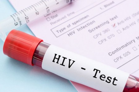 HIV-test